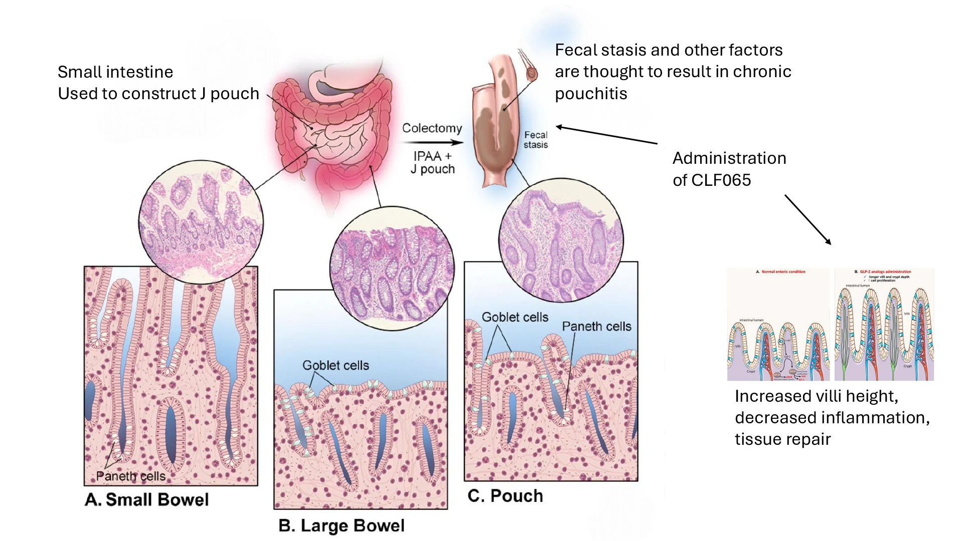 Lightner Website Figure